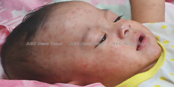 Measles cuts a deadly path through Asean